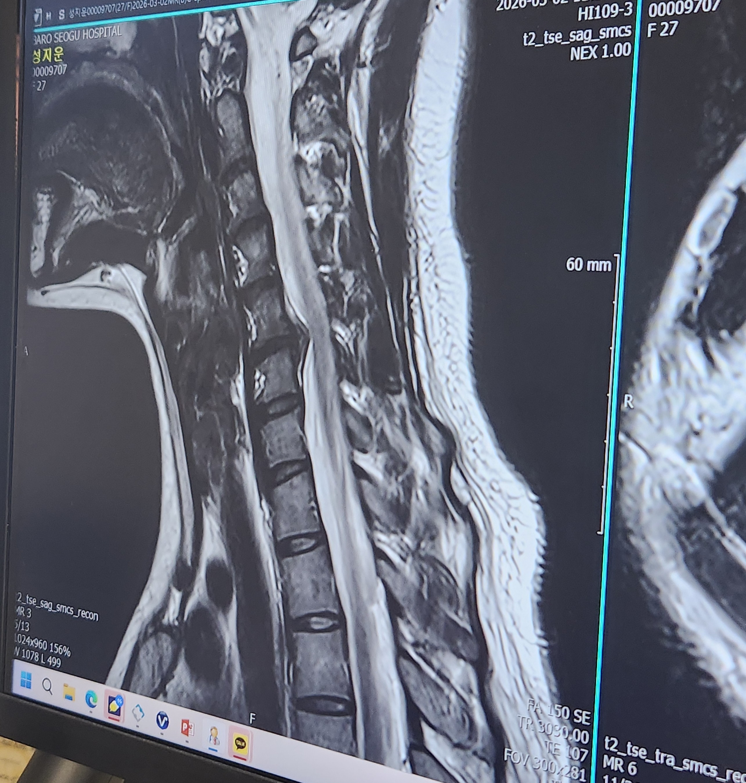 260302 목 mri 사진.jpg